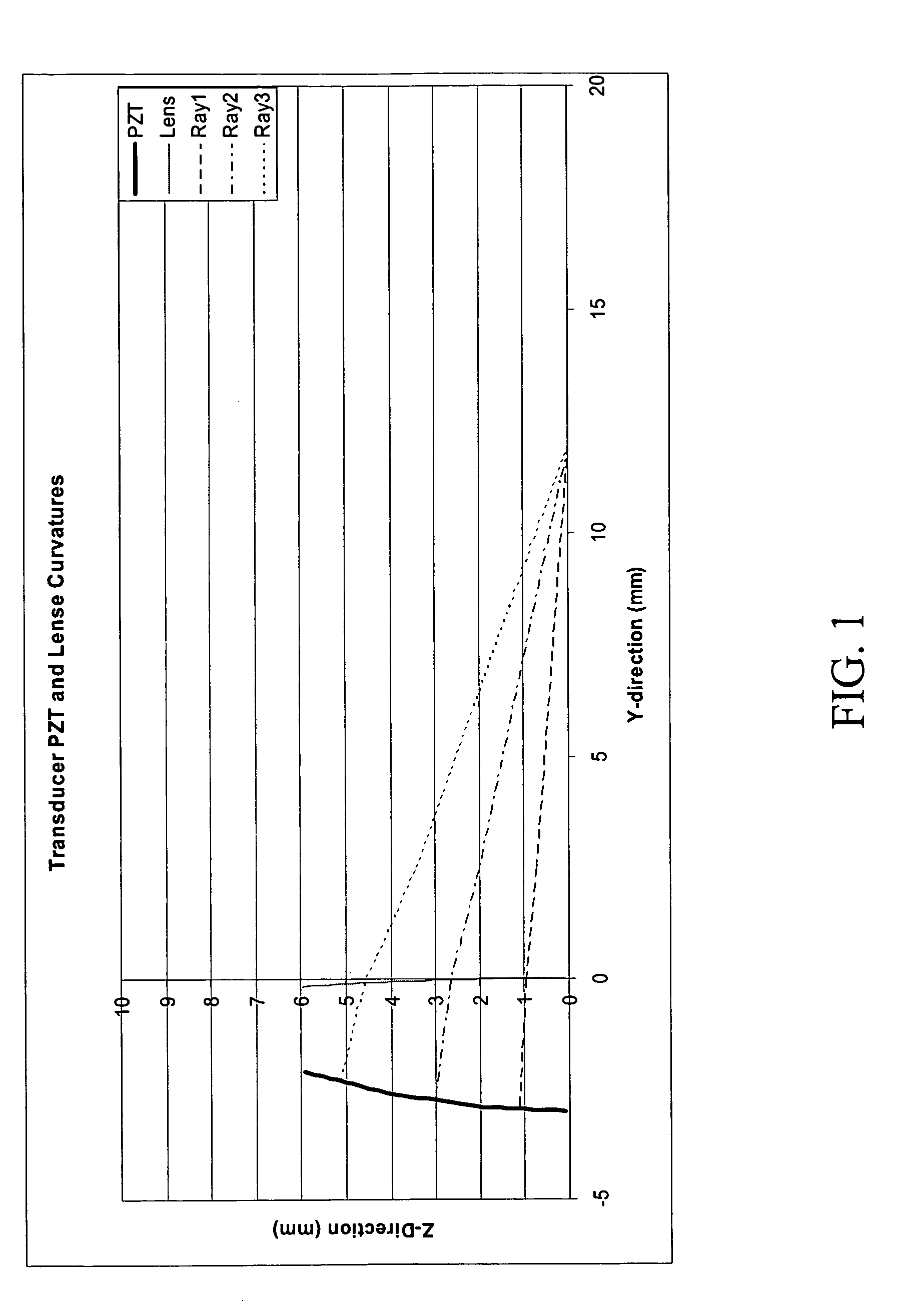 External ultrasound lipoplasty