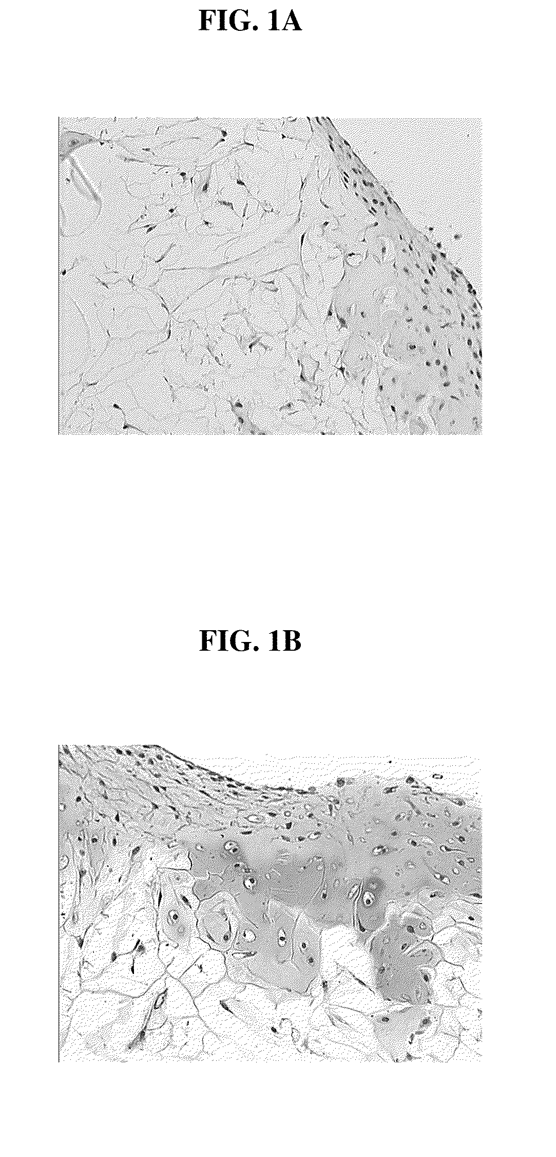 Biocompatible scaffolds with tissue fragments