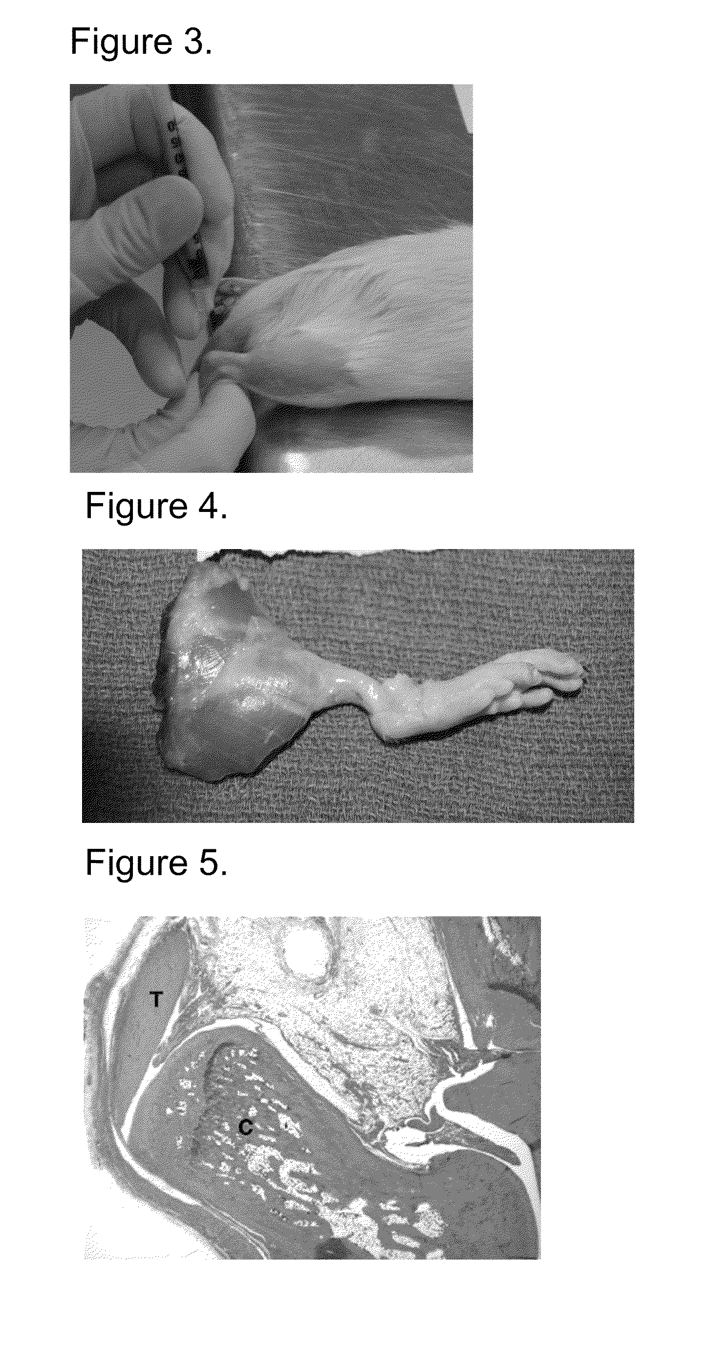 Platelet-derived growth factor compositions and methods for the treatment of tendinopathies