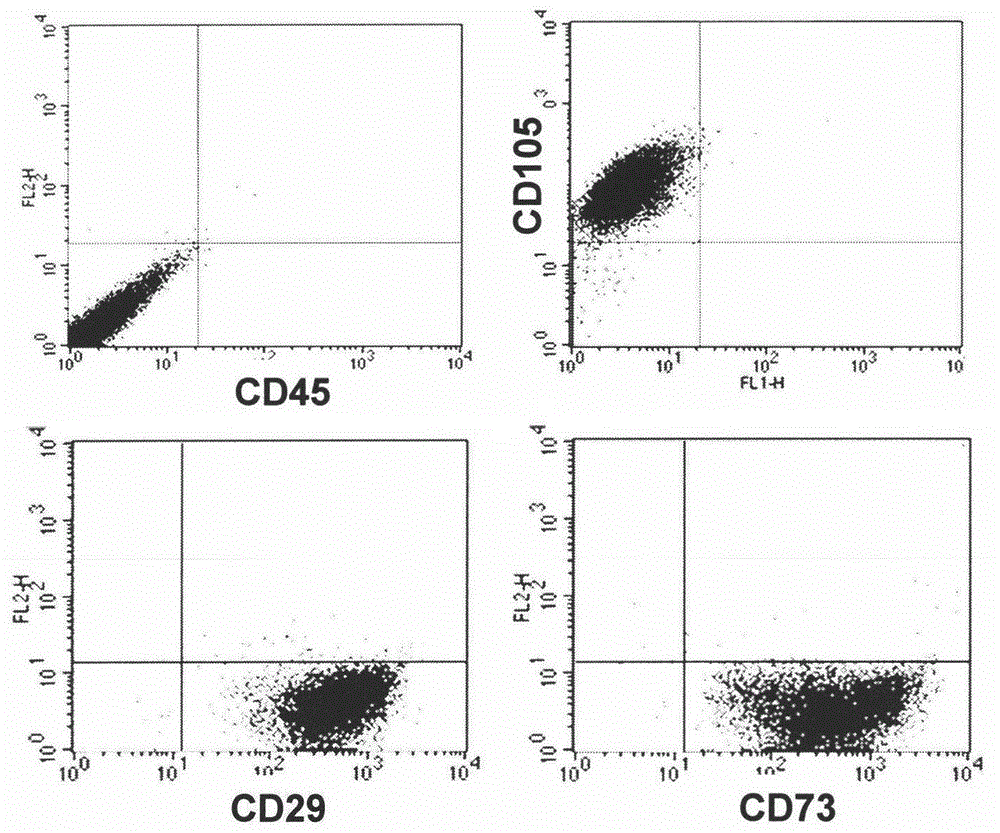 Stem cell extract product for eliminating skin striae gravidarum