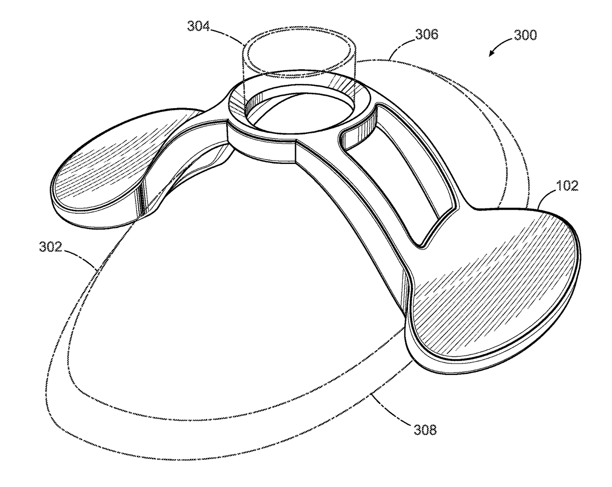 Mask ventilation assist device