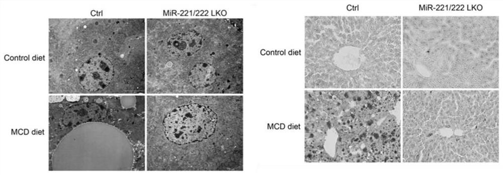 mir-221/222 and its inhibitors are used to prepare drugs for regulating hepatic fat deposition, liver fibrosis and hepatocellular carcinoma