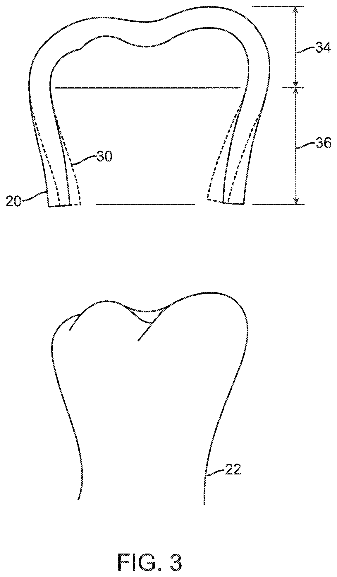 Shape engineered aligner—auto shaping