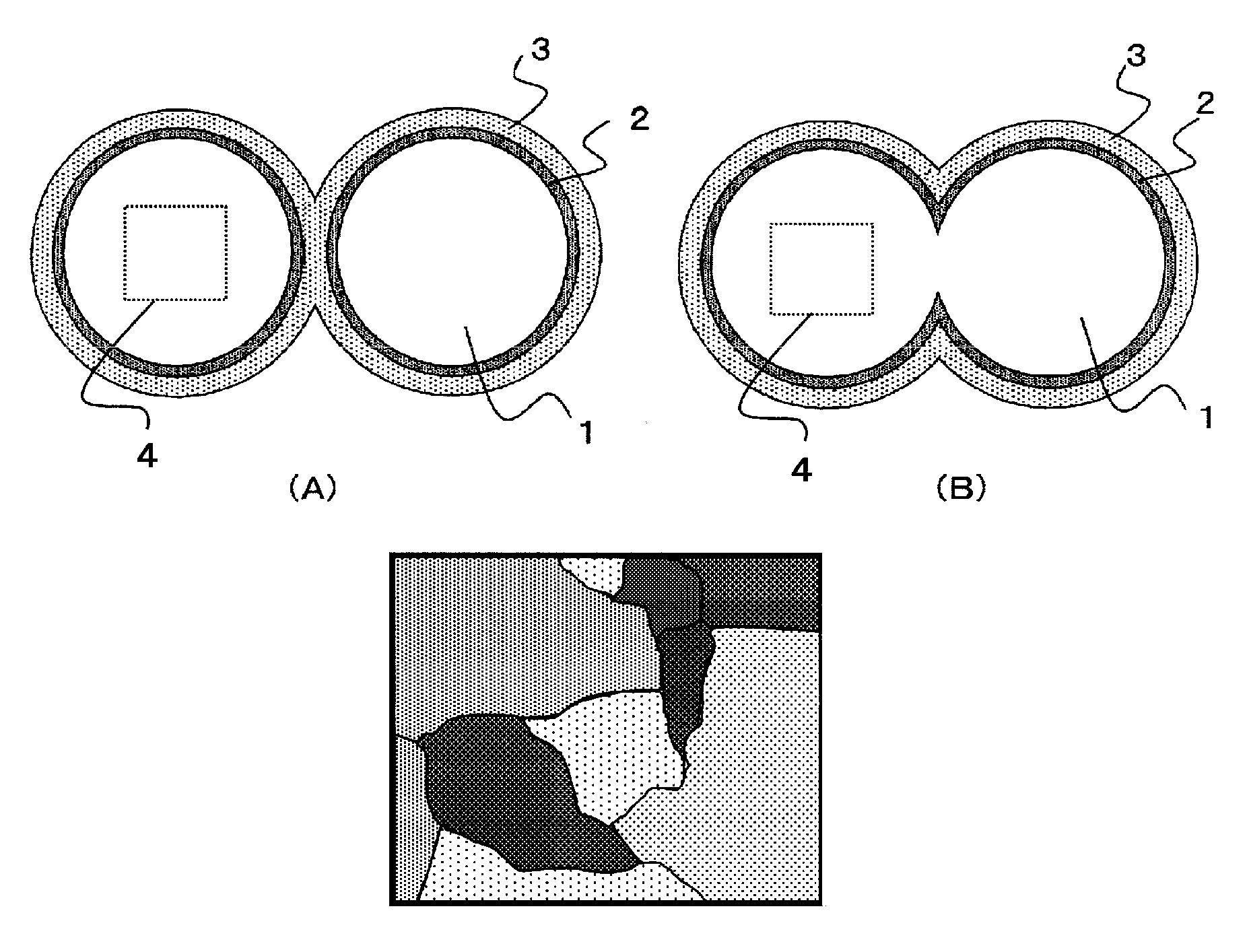 Coil-type electronic component