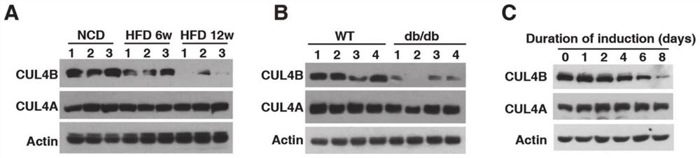 Application of CUL4B in treatment of type 2 diabetes mellitus