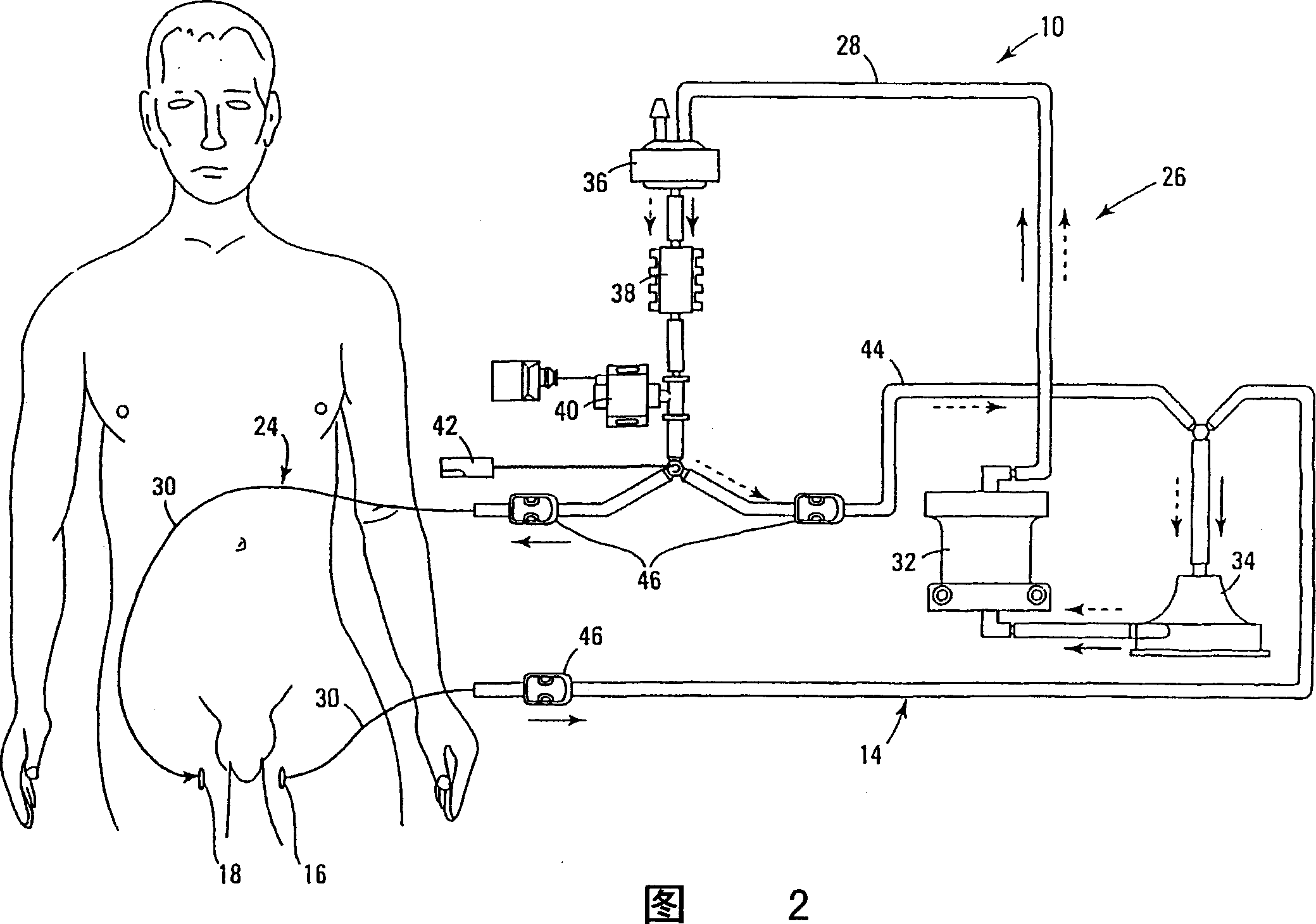 Treatment of human herpesviruses using hyperthermia