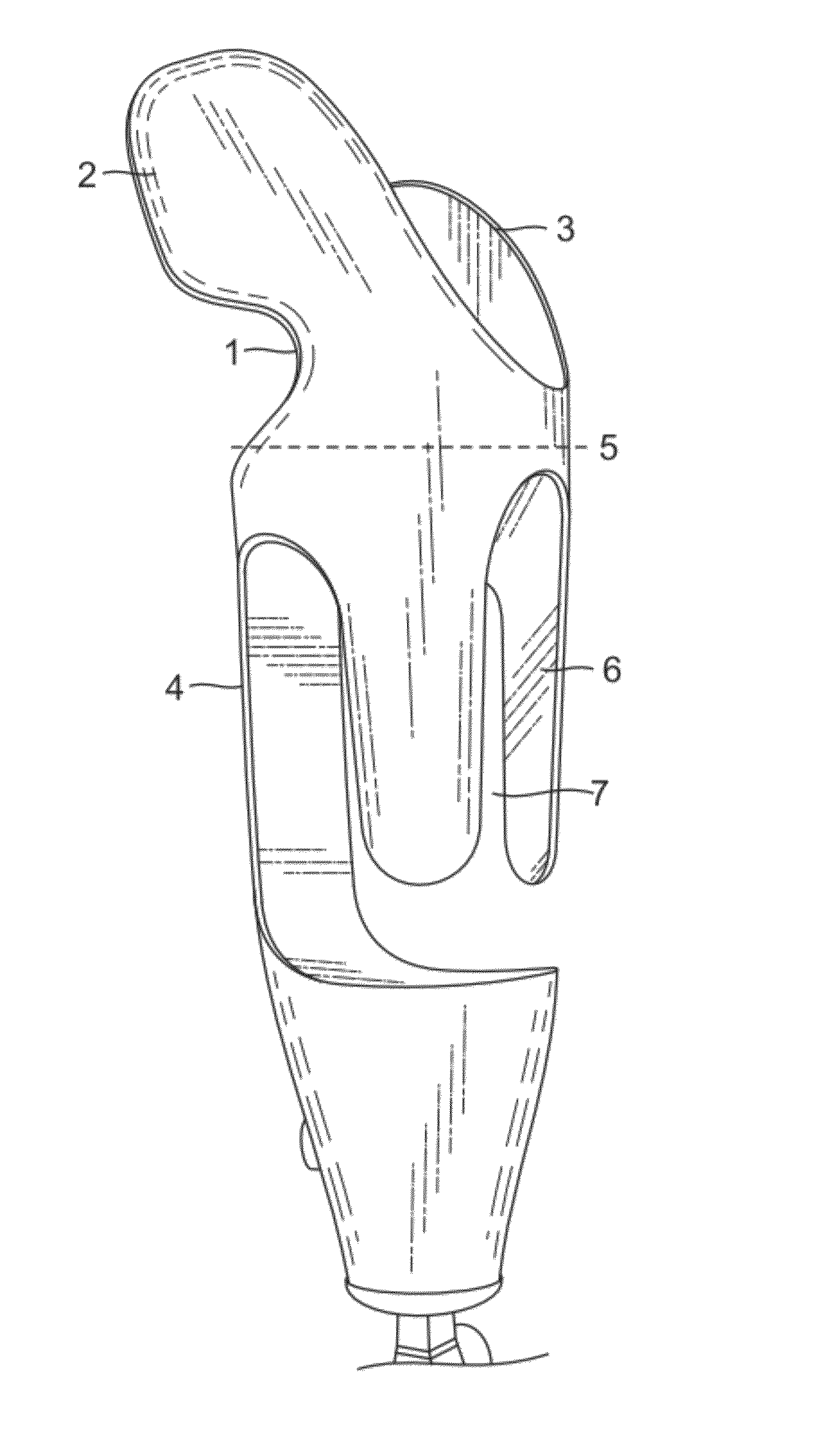 Method for use of a compression stabilized prosthetic socket interface