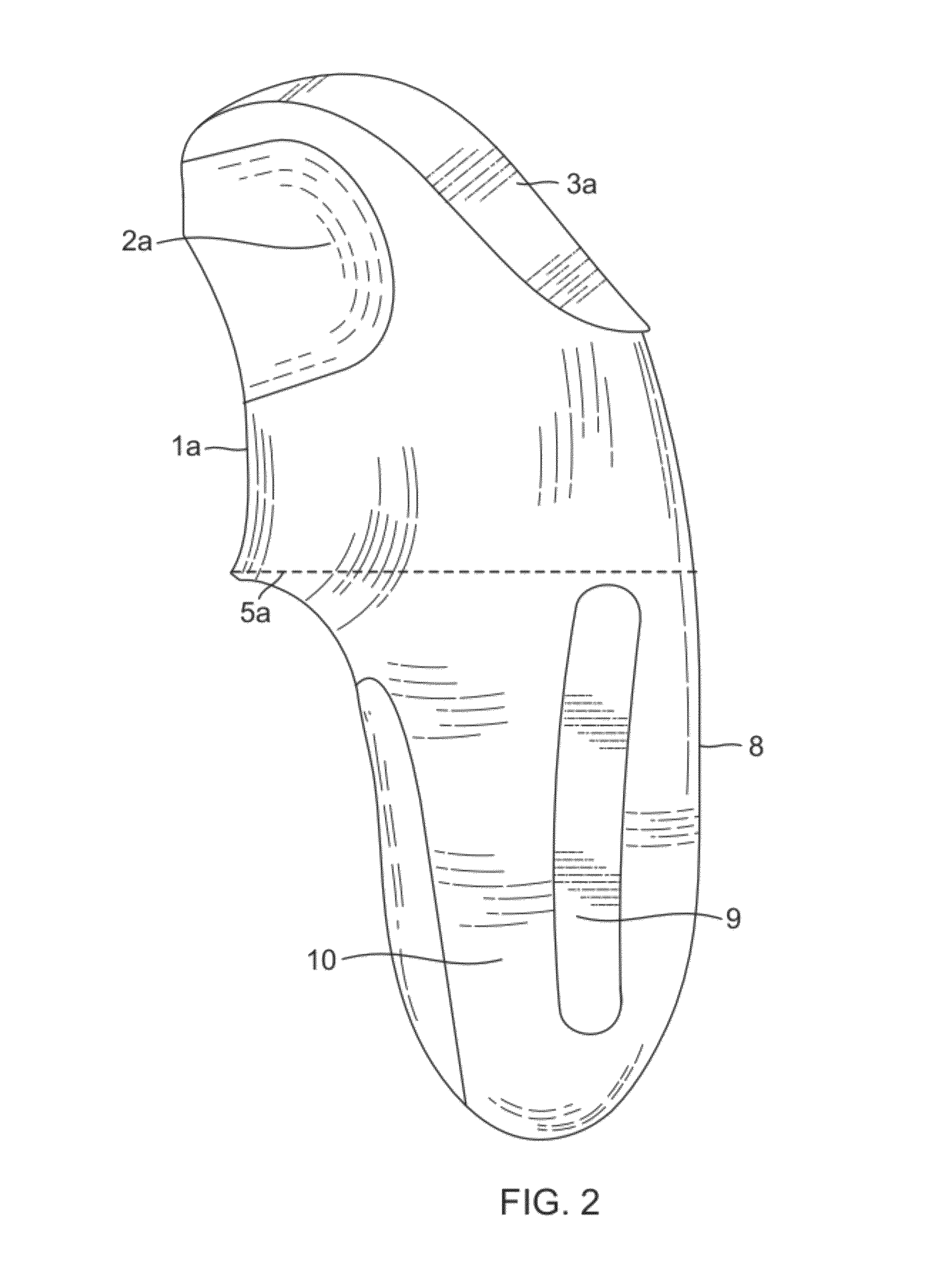 Method for use of a compression stabilized prosthetic socket interface