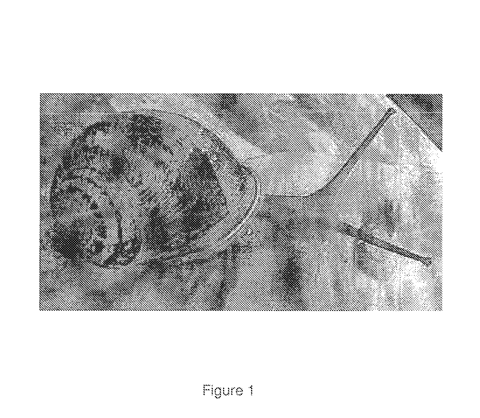 Pharmaceutical composition and device for preventing, treating and curing ulcers on a diabetic foot and other wounds, which includes snail slime from the species <i>Cryptophalus aspersus </i>or <i>Helix aspersa muller </i>and pharmaceutically acceptable carriers and/or additives