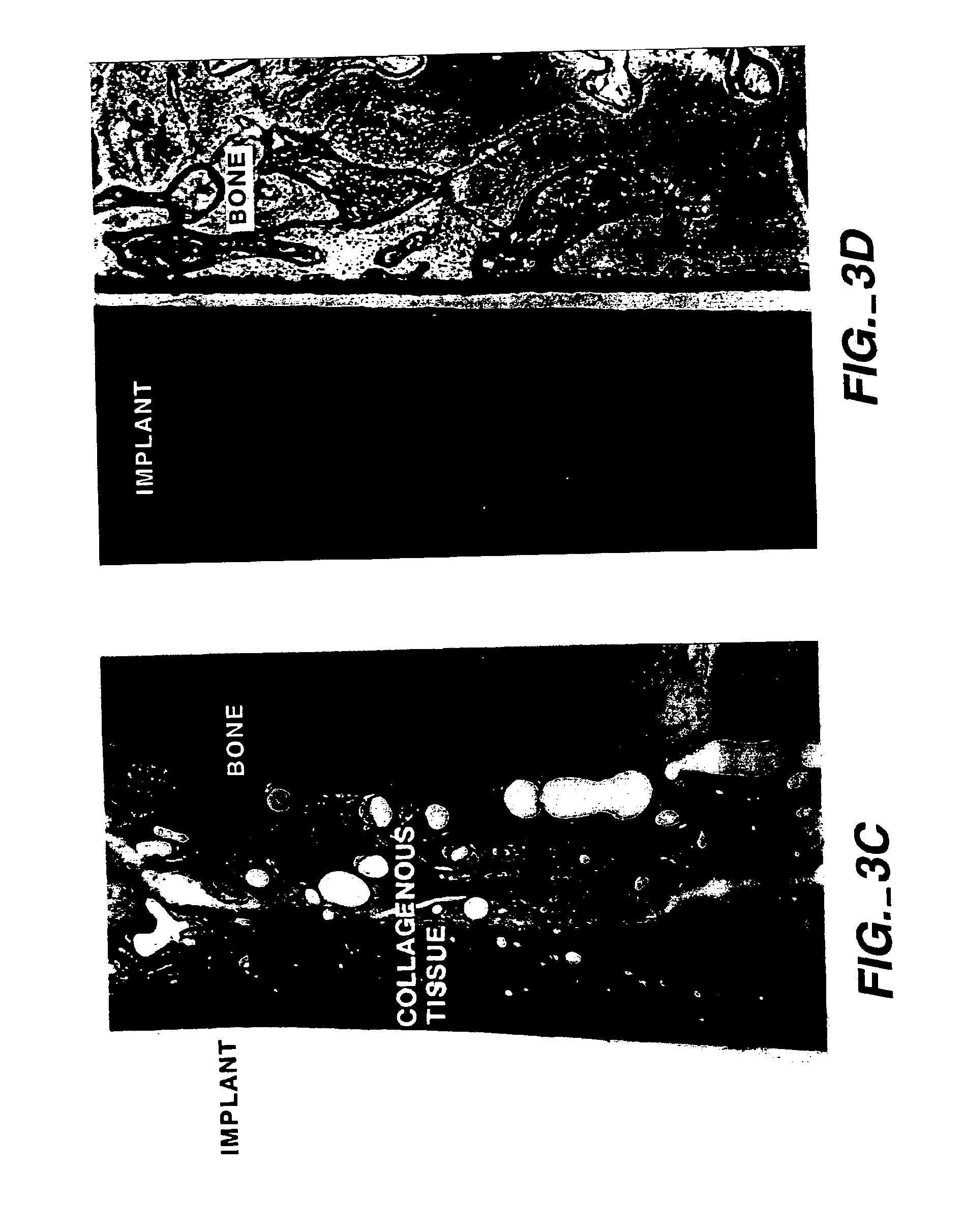 Combined use of cementum attachment protein and cyclosporin a for improved attachment of dental and orthopedic implants