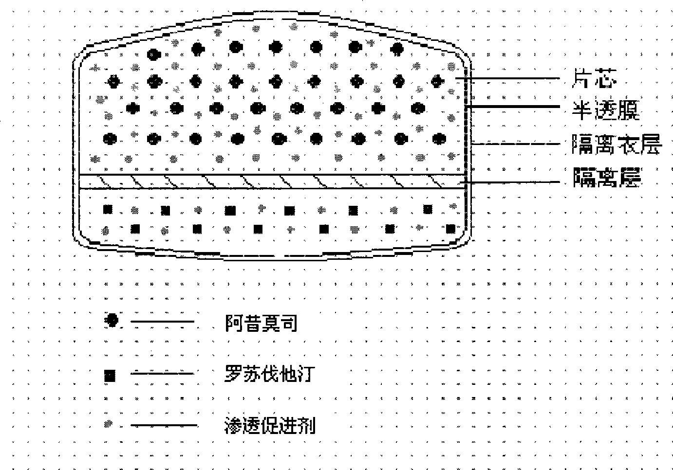 Osmotic pump controlled release preparation composition for treating hyperlipemia and preparation method thereof