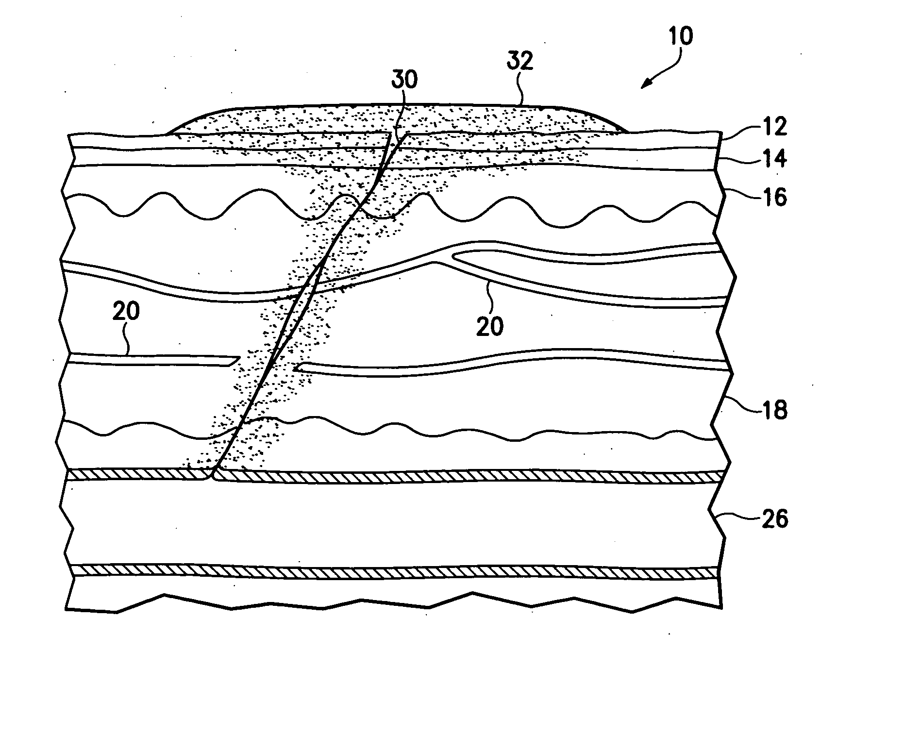 Hemostatic compound and its use