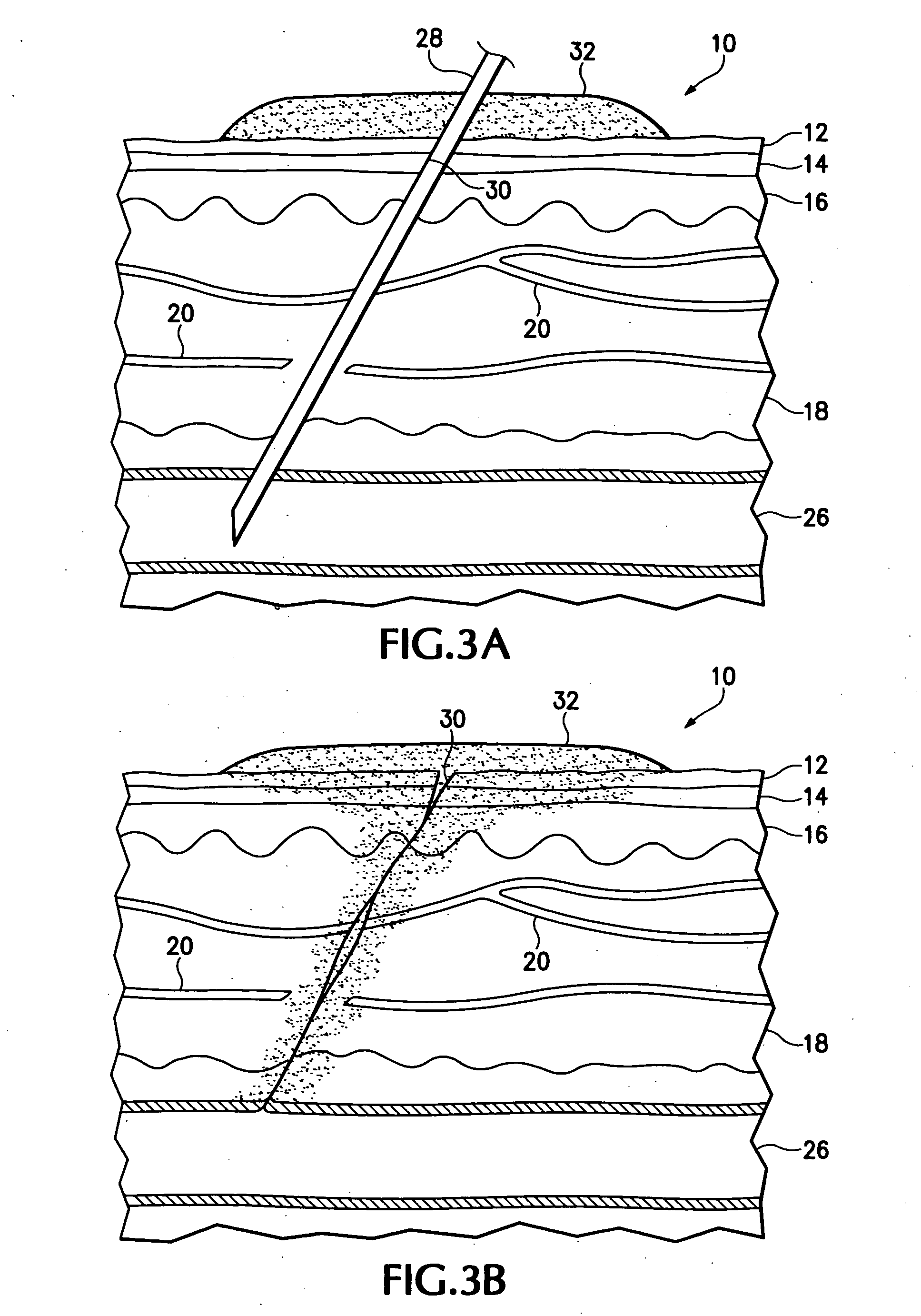 Hemostatic compound and its use