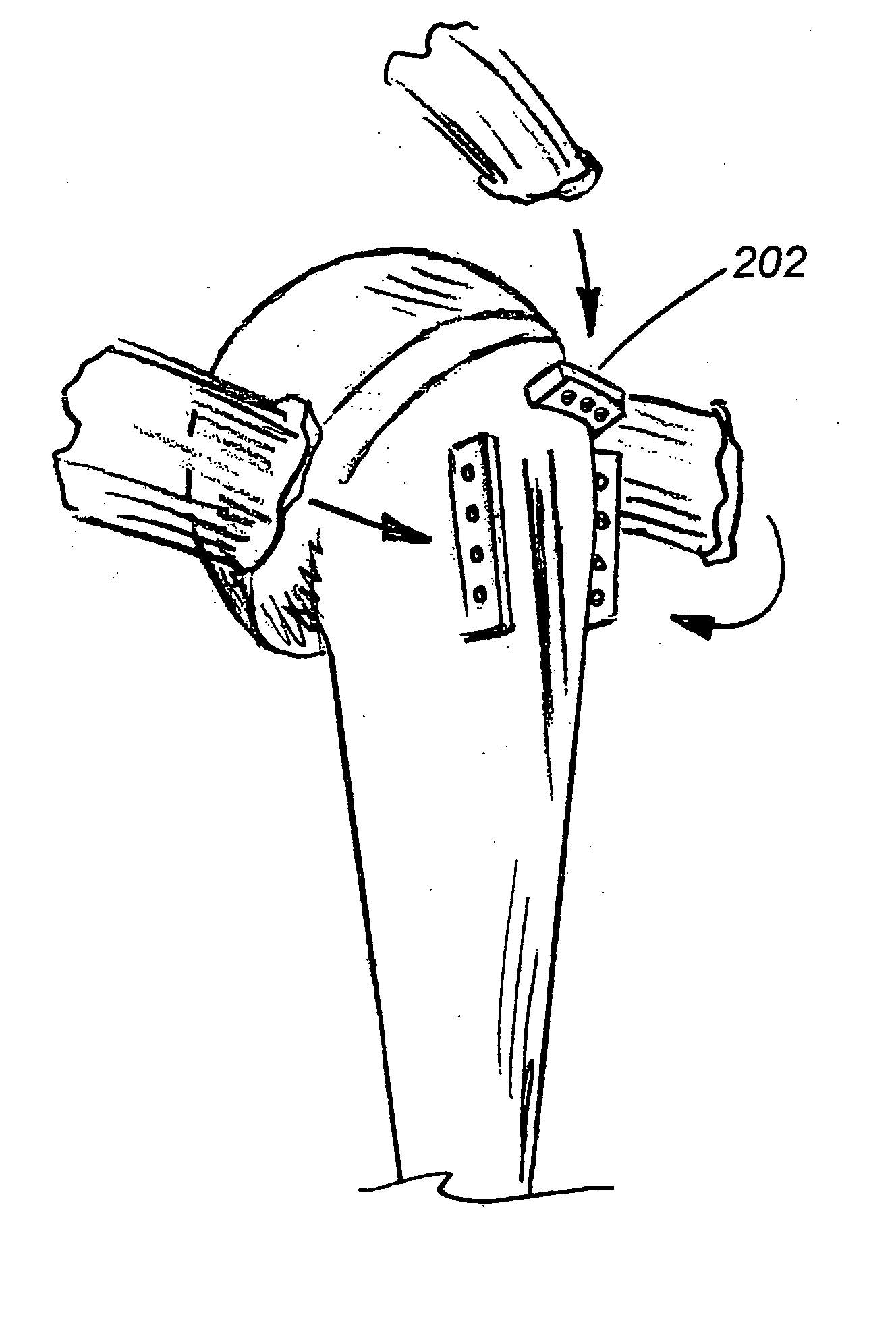 Shoulder prosthesis with anatomic reattachment features