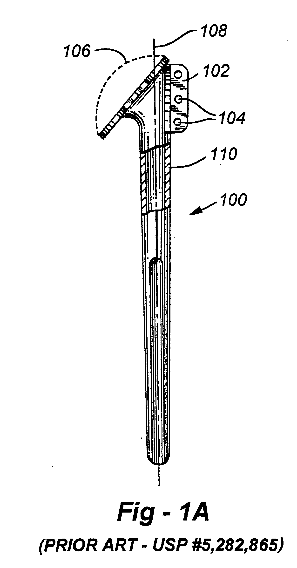 Shoulder prosthesis with anatomic reattachment features