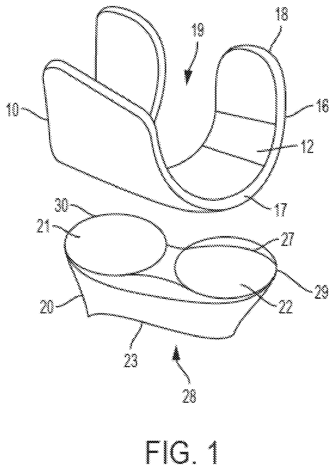 Lateral and medial pivoting knee prosthesis