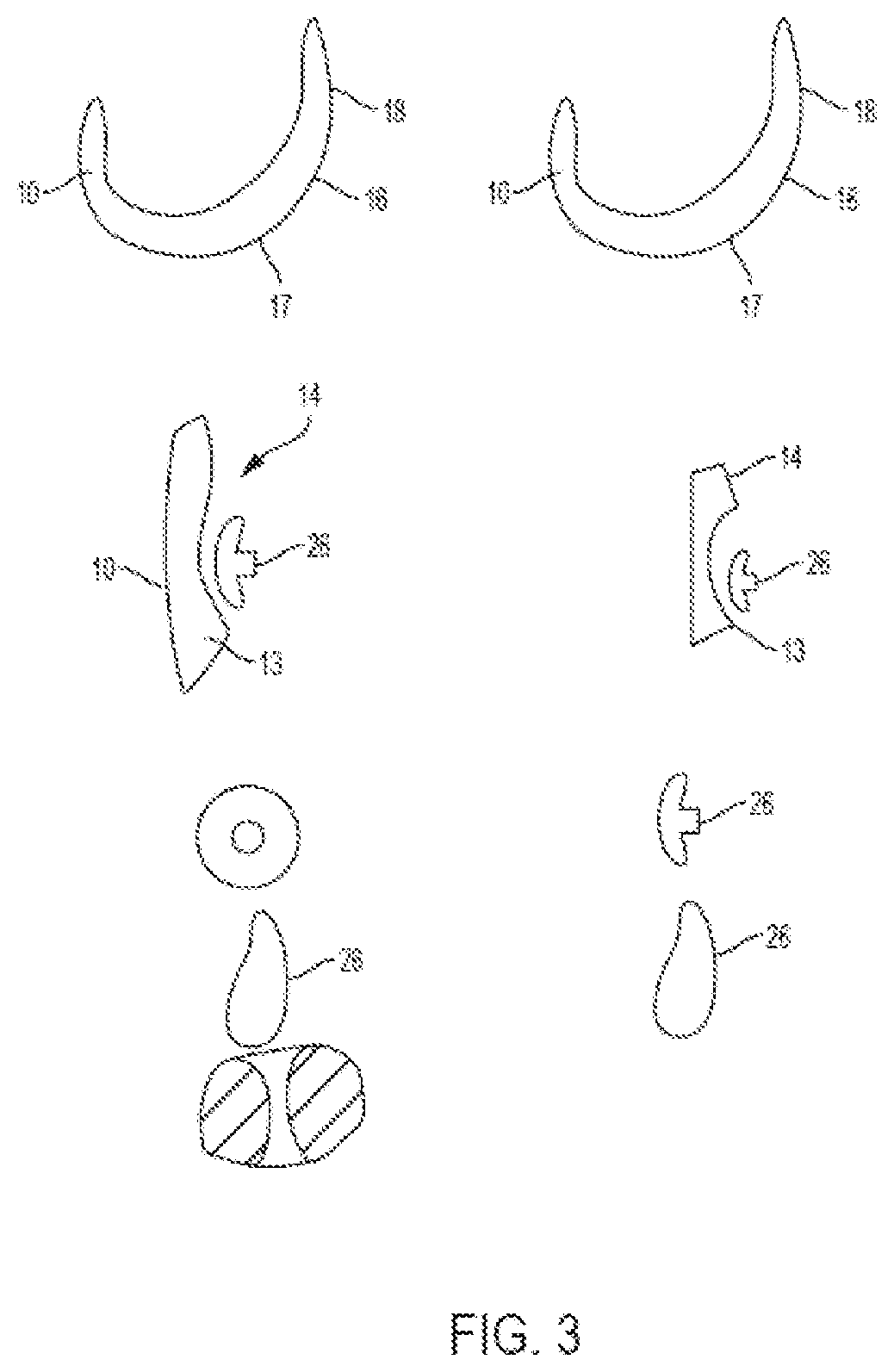 Lateral and medial pivoting knee prosthesis