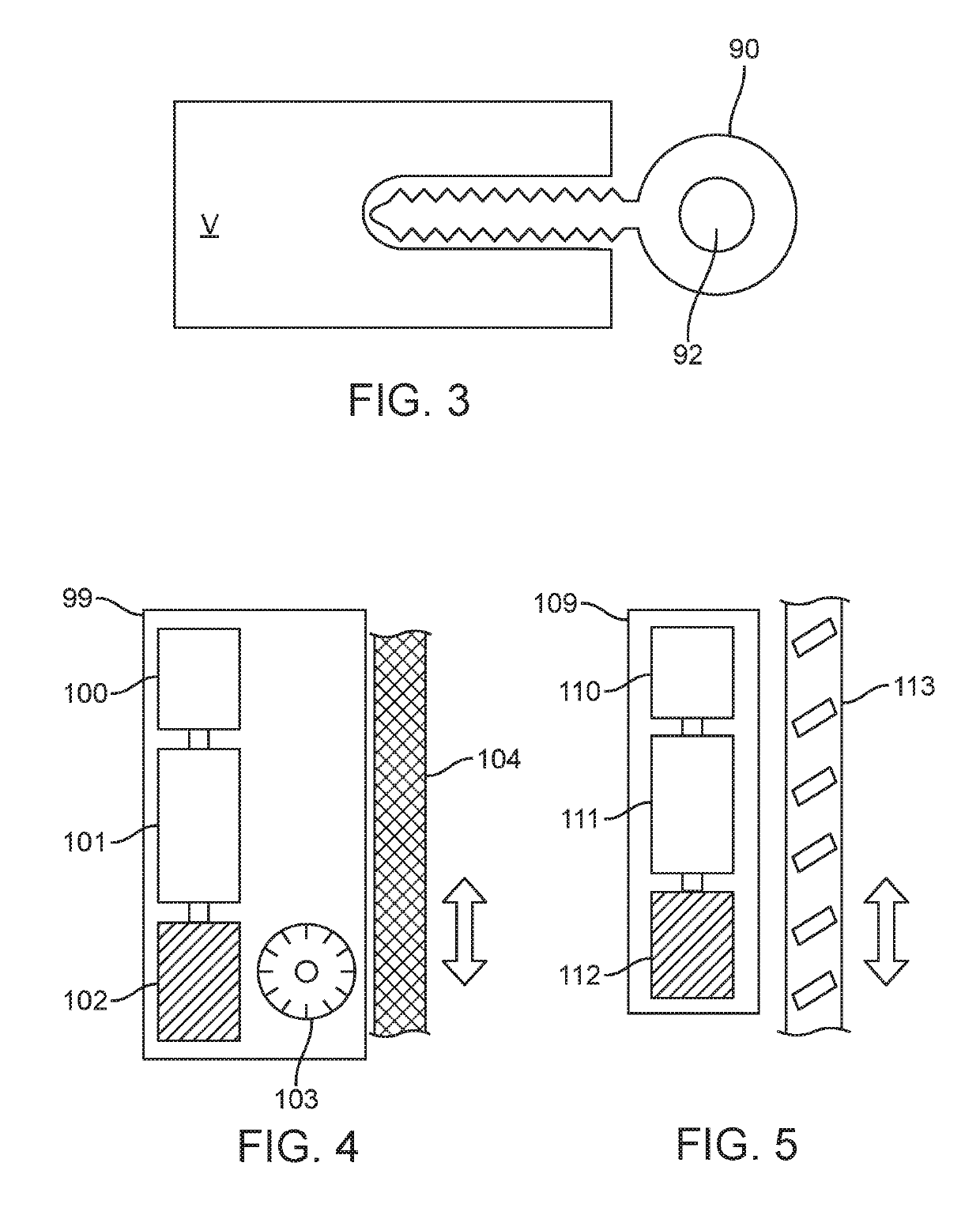 Spinal Curvature Modulation Systems and Methods