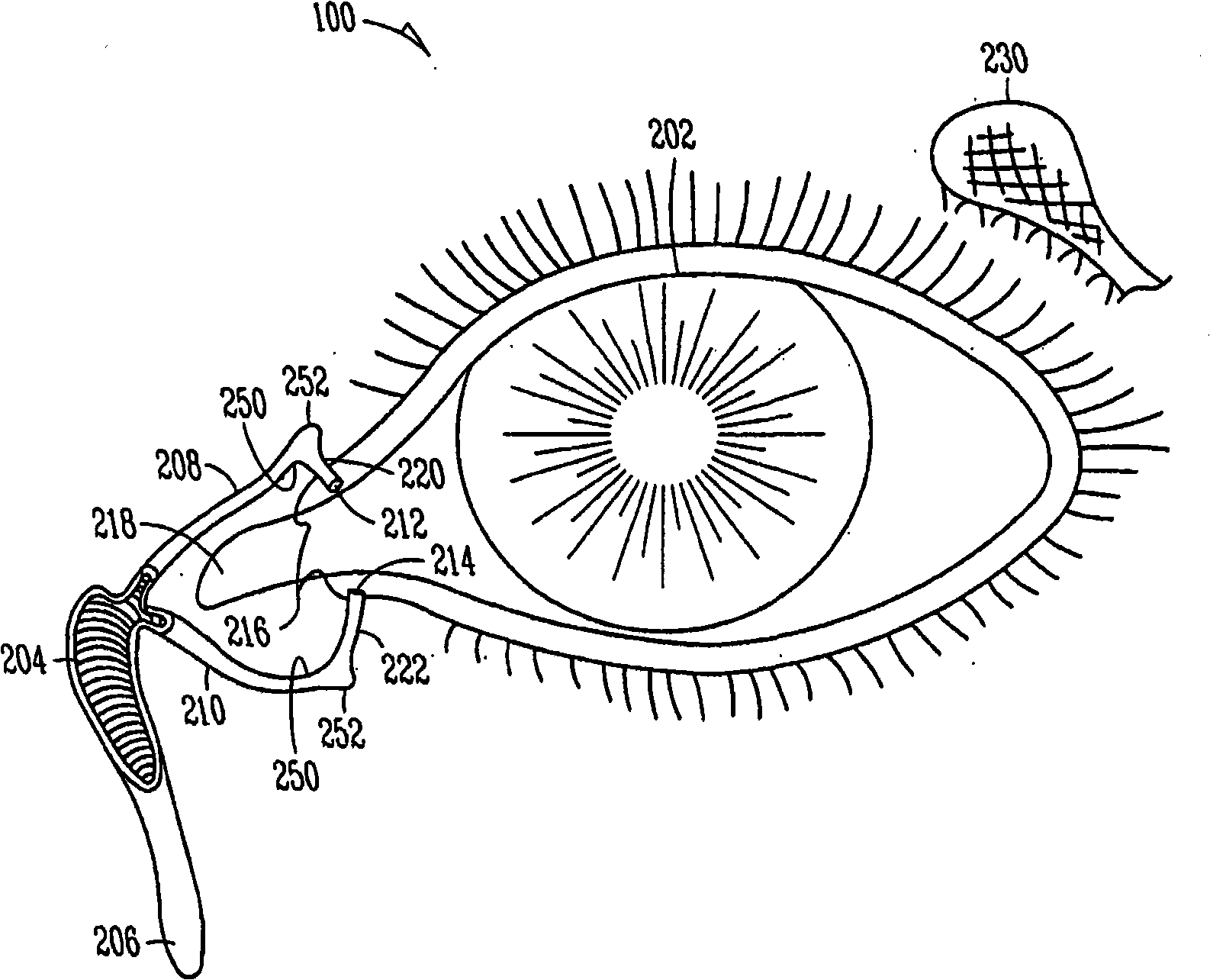 Lacrimal implants and related methods