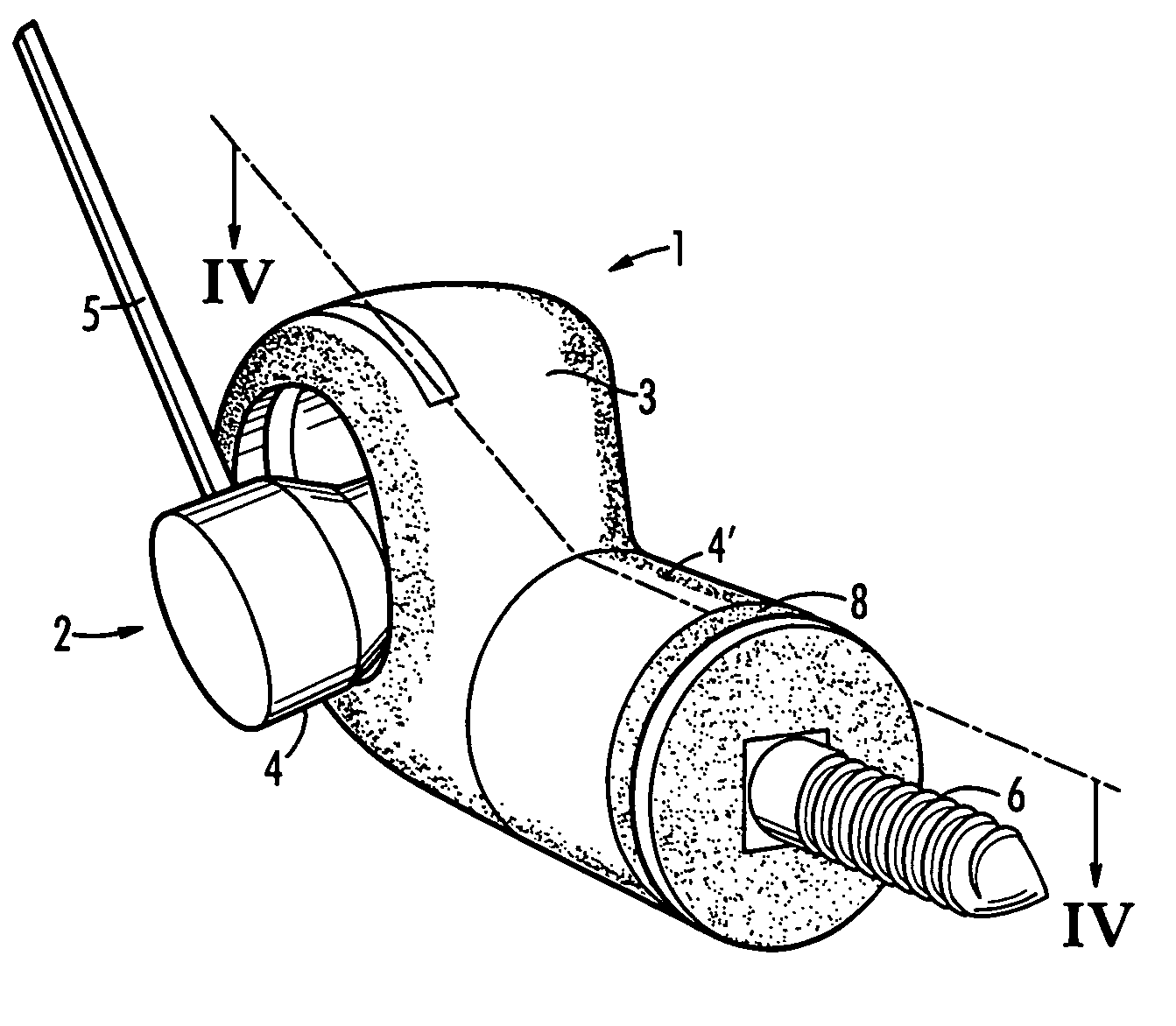 Ball joint for a device used for accelerating jaw growth