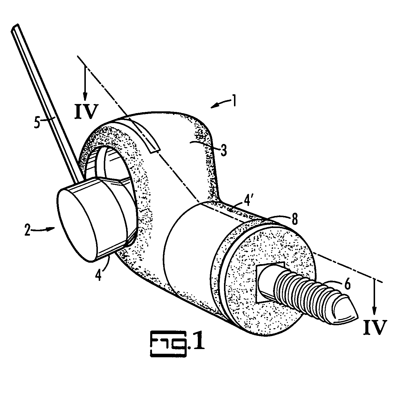 Ball joint for a device used for accelerating jaw growth