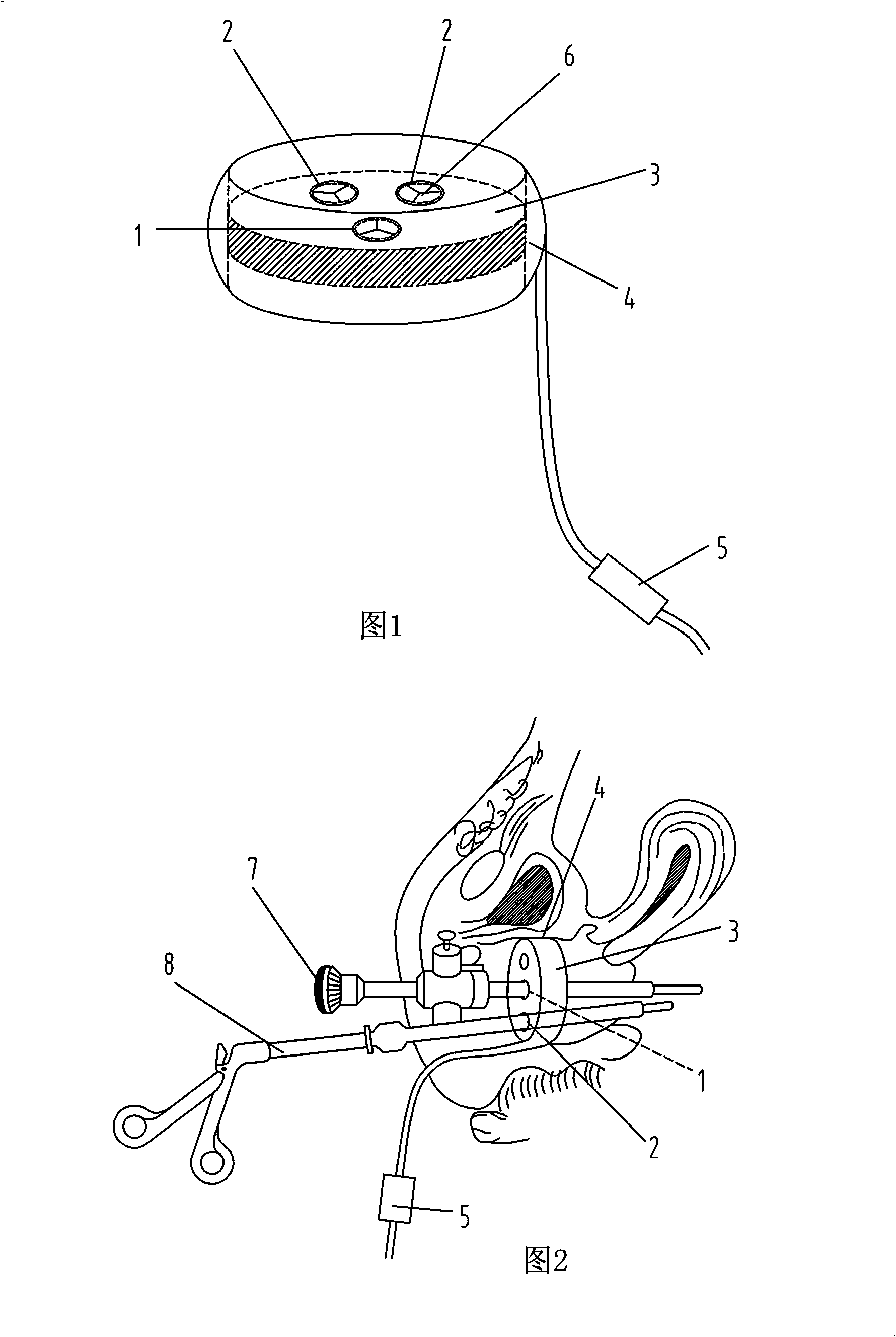 Vaginal celioscope operation auxiliary device