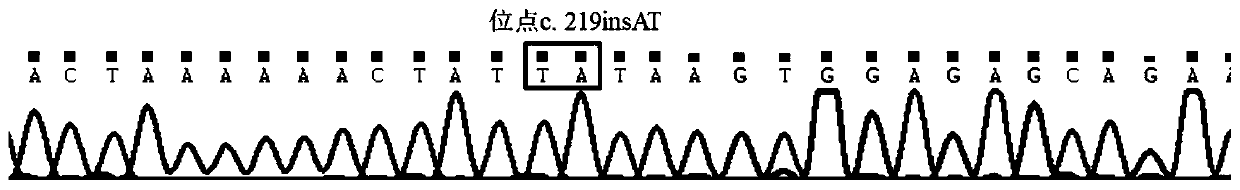 Primer group for detection of vitamin E metabolism gene TTPA (tocopherol (Alpha) transfer protein) and multiple PCR (polymerase chain reaction) detection method