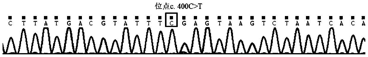 Primer group for detection of vitamin E metabolism gene TTPA (tocopherol (Alpha) transfer protein) and multiple PCR (polymerase chain reaction) detection method