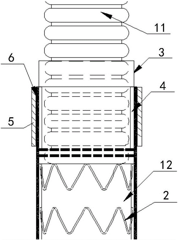 Suturing-free stent artificial blood vessel, conveying device thereof and coincident retaining ring