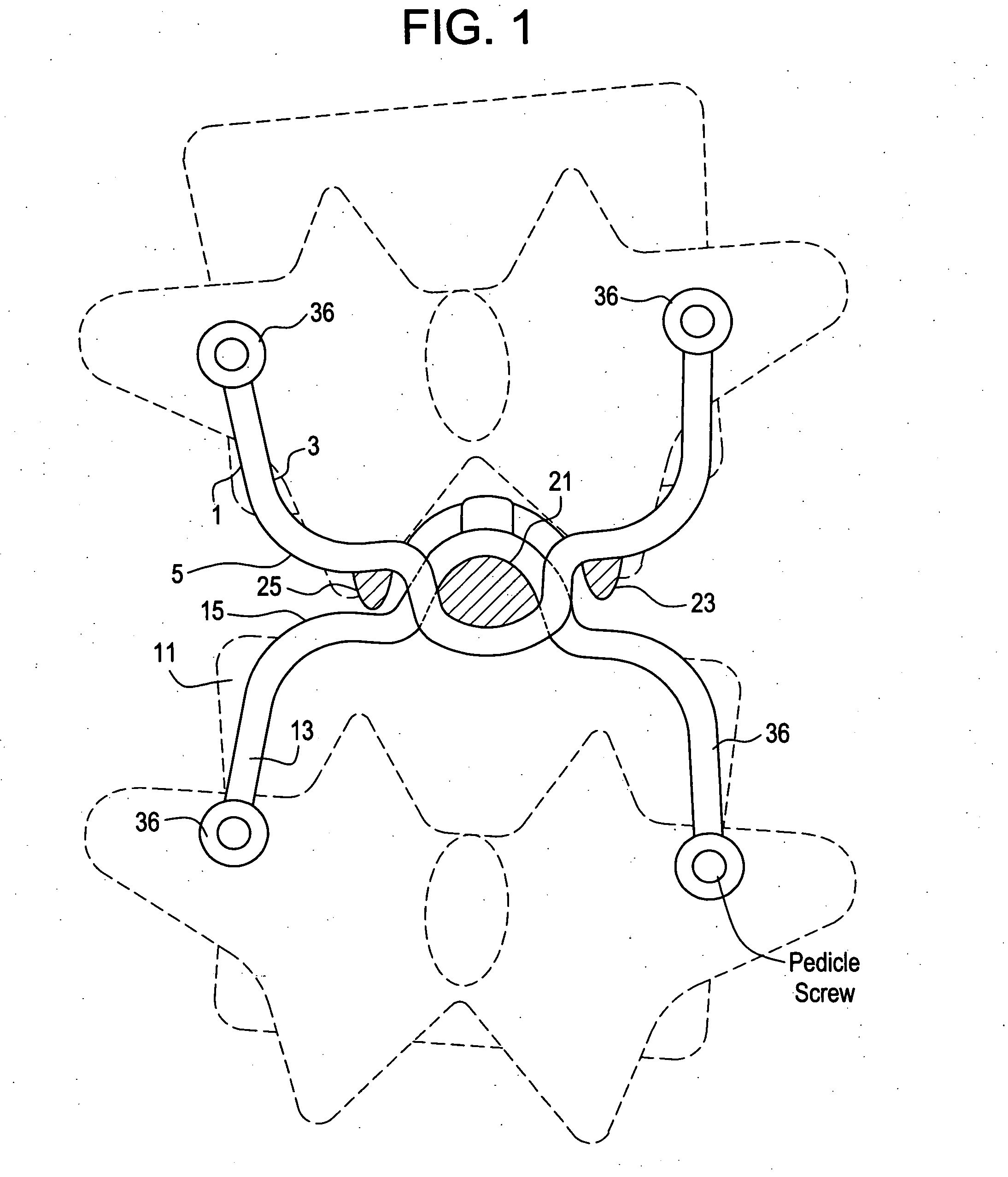 Artificial facet joint device having a compression spring