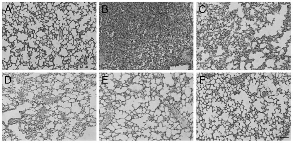 Use of ferric acid in preparing medicine for treating pneumonia