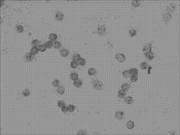 Kit and method for detecting horizontal in situ hybridization of MICRORNA-520 at the early pathological evolution stage of a variety of cancers and application thereof