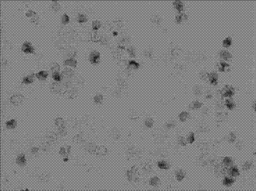 Kit and method for detecting horizontal in situ hybridization of MICRORNA-520 at the early pathological evolution stage of a variety of cancers and application thereof