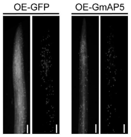 Gene GmAP5 for improving disease resistance of plants and use of gene GmAP5