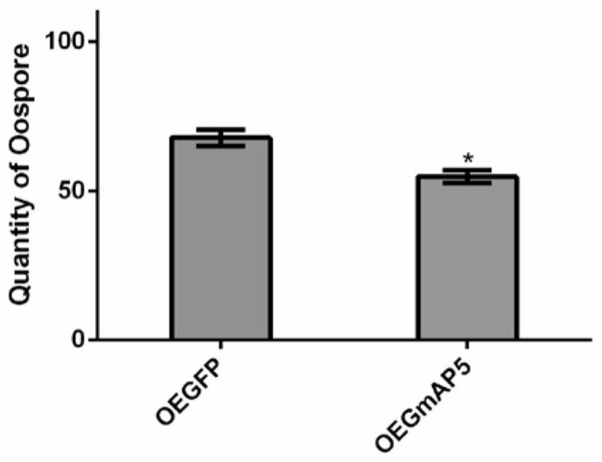 Gene GmAP5 for improving disease resistance of plants and use of gene GmAP5