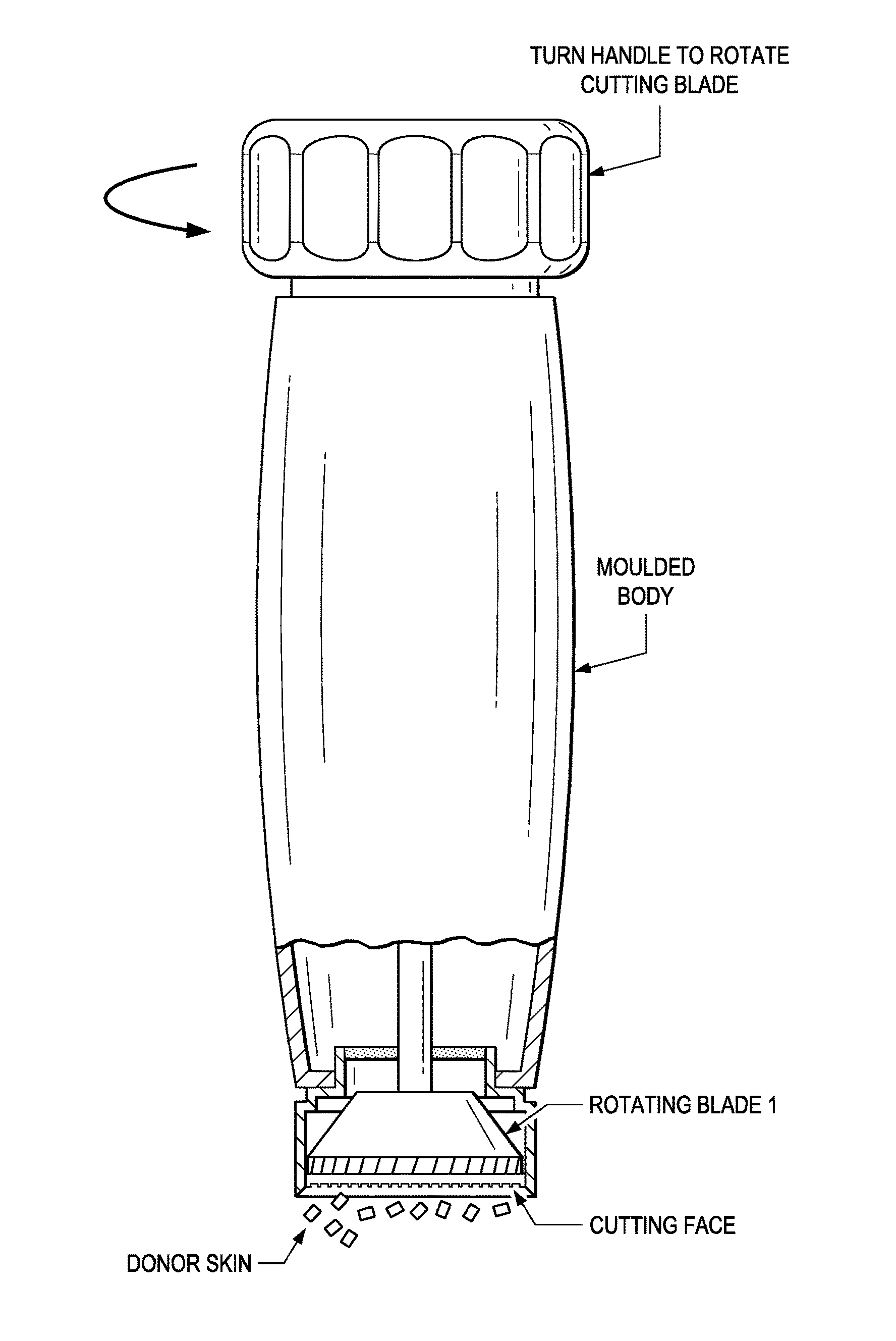 Skin graft devices and methods