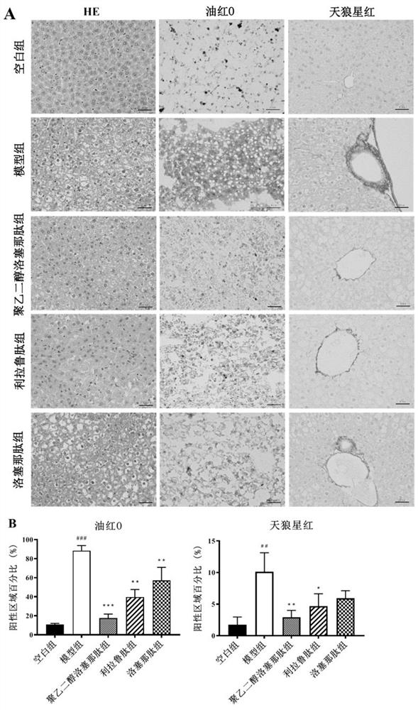 New medical application of polyethylene glycol loxenatide or pharmaceutical composition thereof