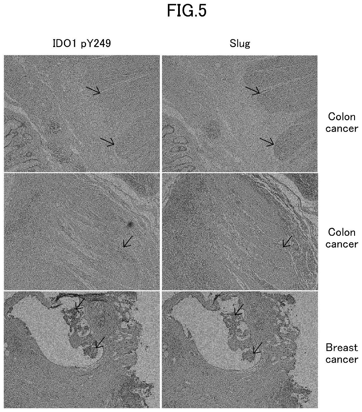 Anti-Tumor Immunotherapy Enhancer