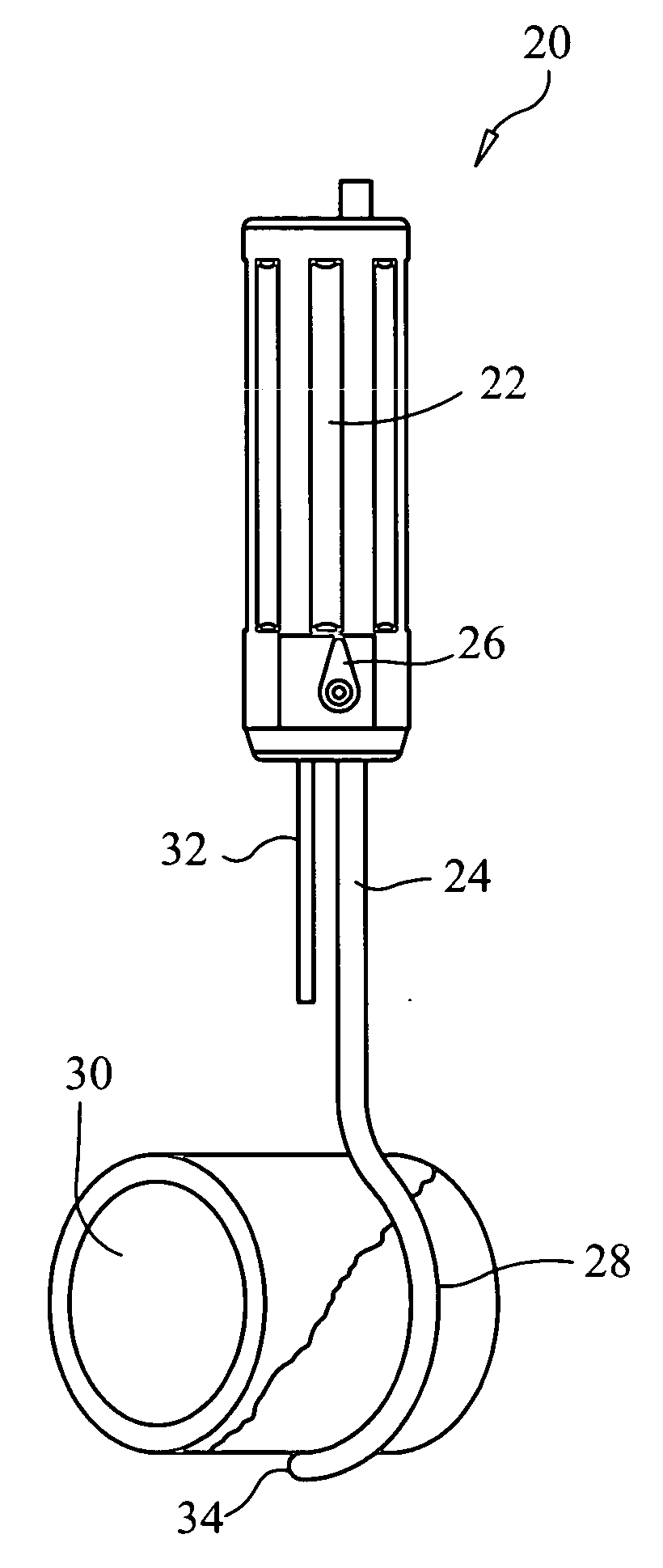 Apparatus and methods for surgery