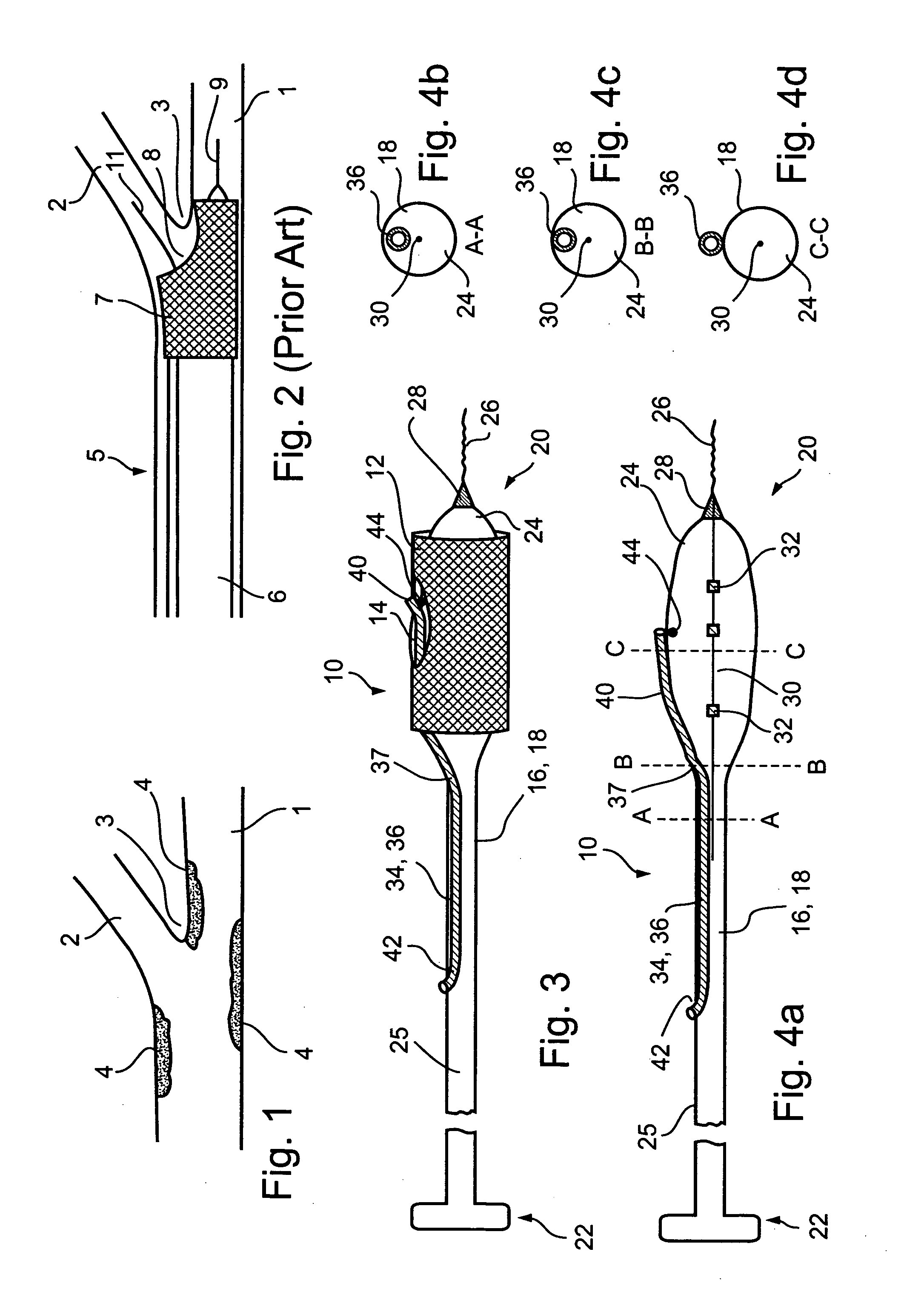 Bifurcation stent delivery devices