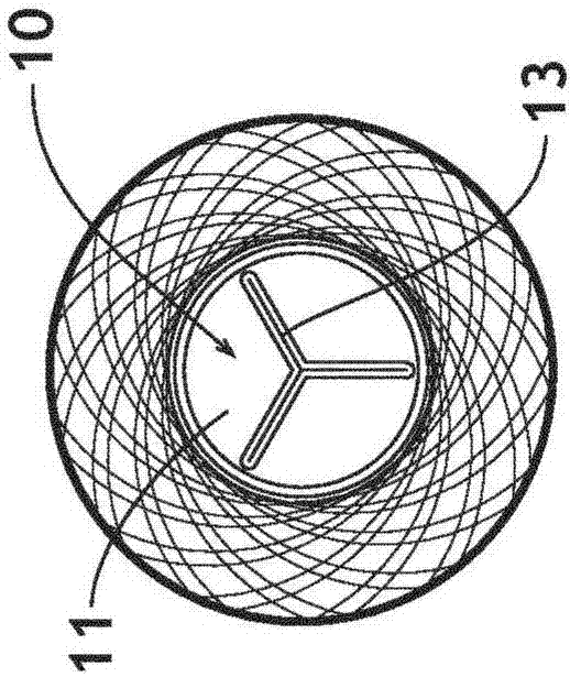 3D filter for prevention of stroke