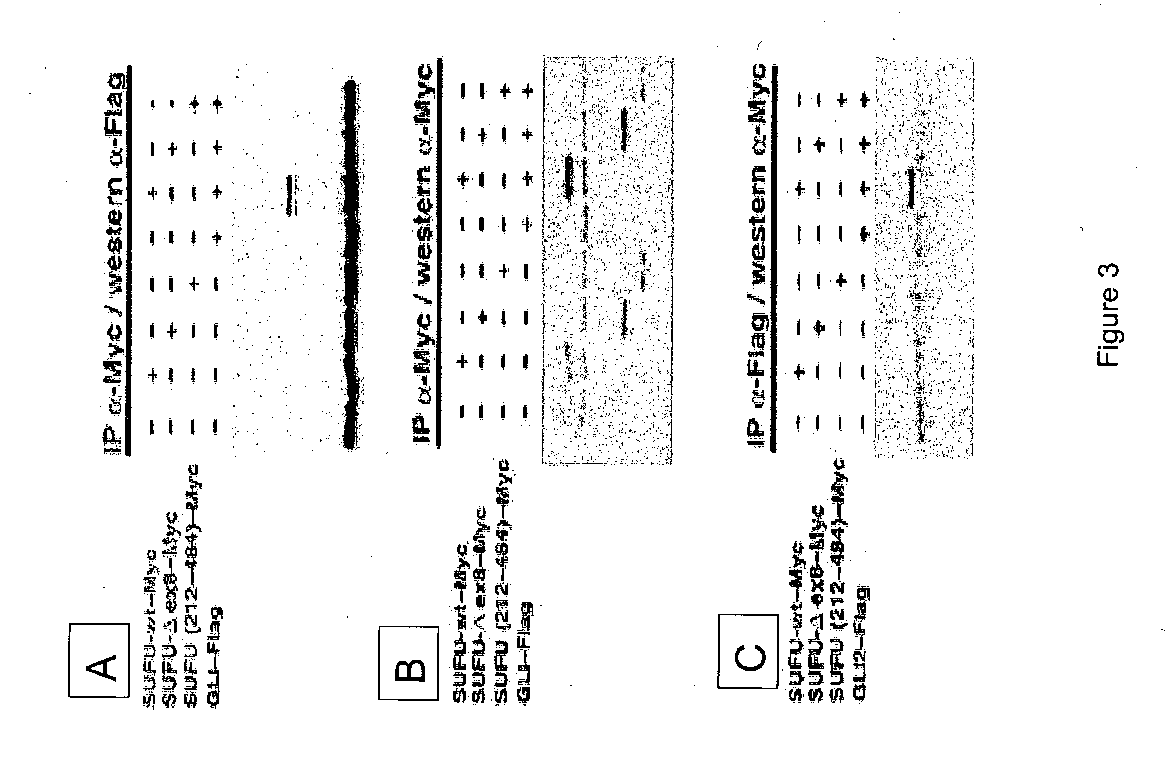 Diagnostic and therapeutic uses of SUFU gene