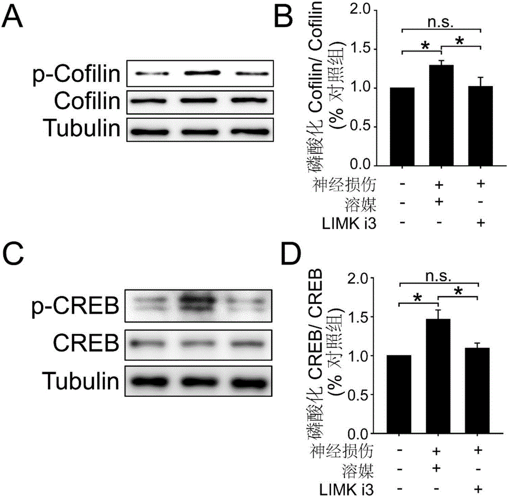 Application of LIM kinase inhibitor LIMKi3 to preparation of drug for treating pains