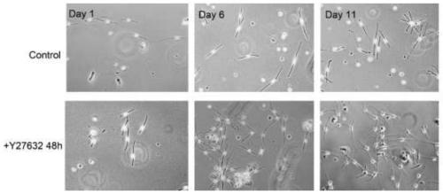 A method for efficiently isolating and culturing human primary melanocytes