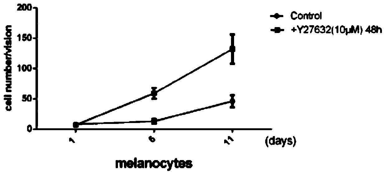 A method for efficiently isolating and culturing human primary melanocytes