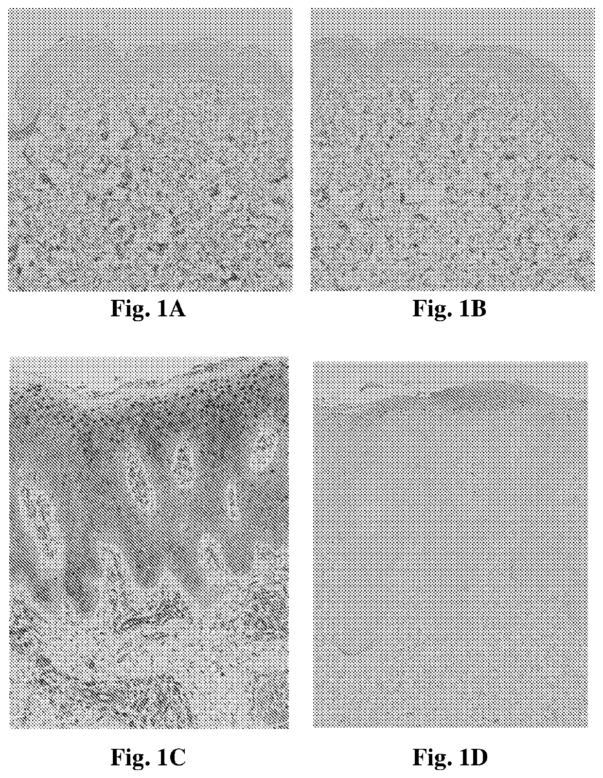 Fabp4 as a therapeutic target in skin diseases