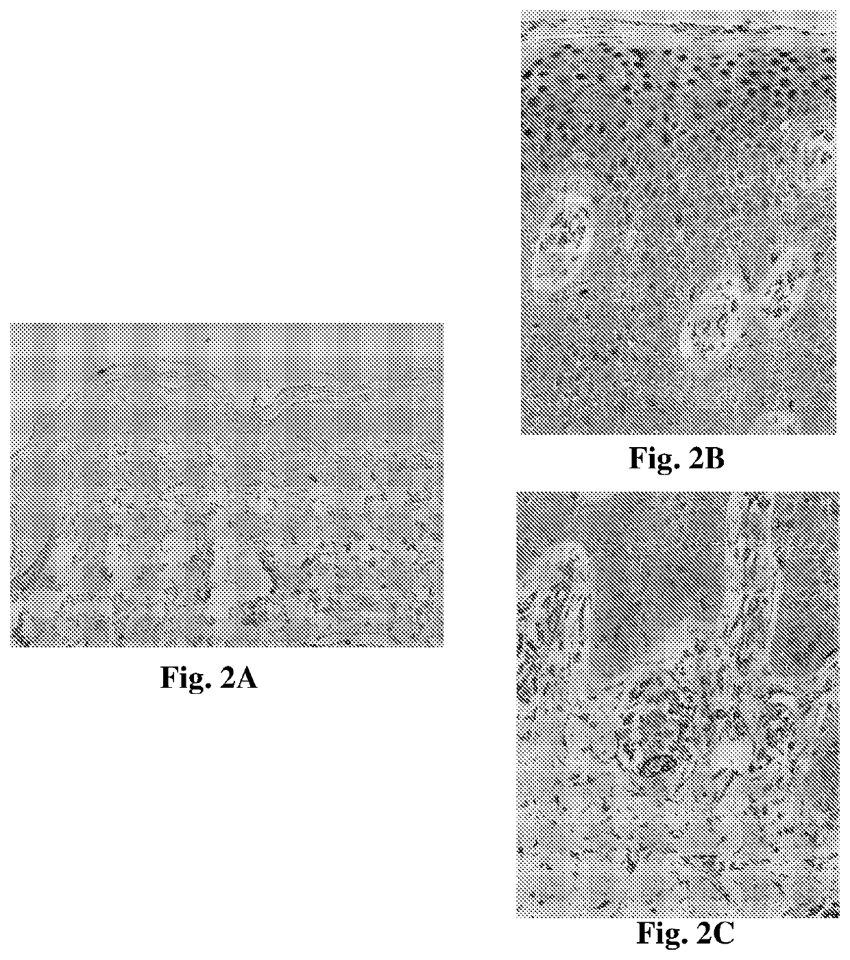 Fabp4 as a therapeutic target in skin diseases