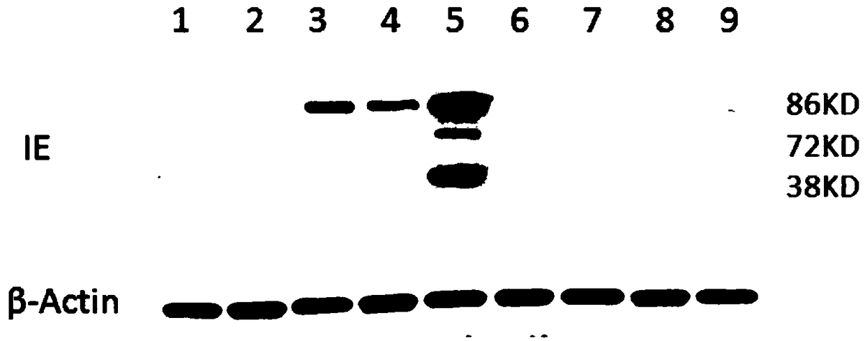 Anti-human-cytomegalovirus drug screening method and application thereof