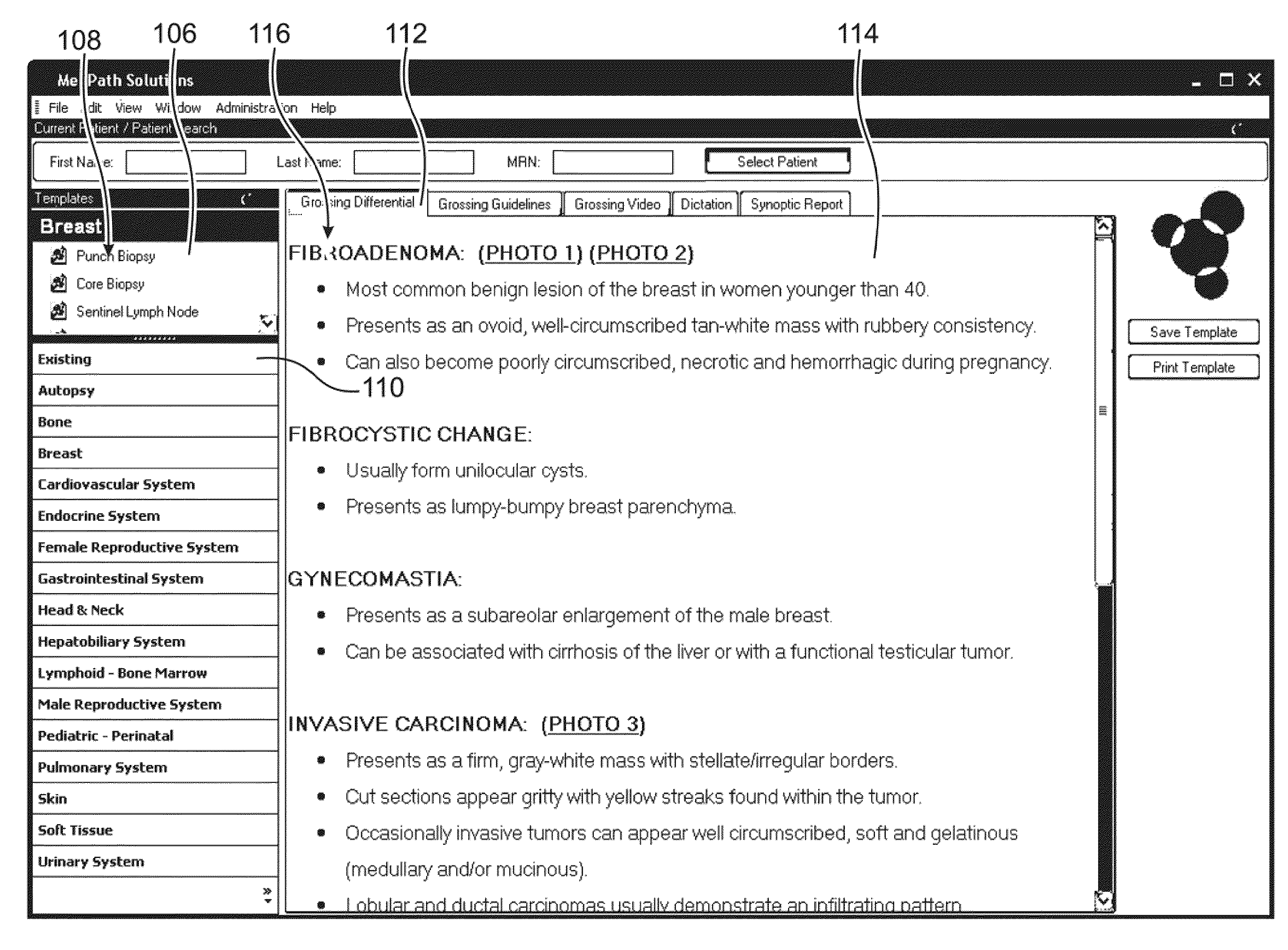 Computer based standardized method and apparatus for guiding decision support for surgical anatomic pathology operations