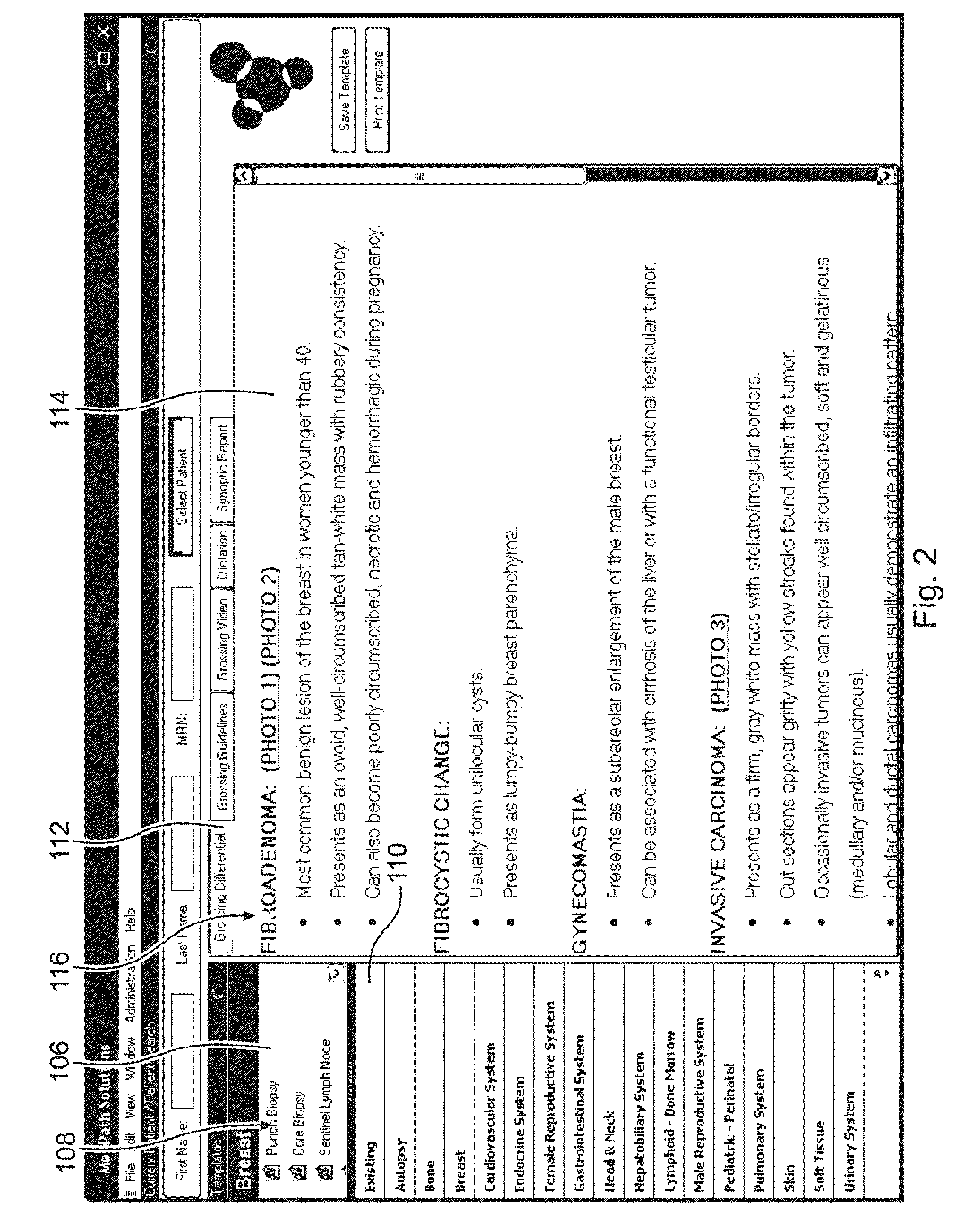 Computer based standardized method and apparatus for guiding decision support for surgical anatomic pathology operations